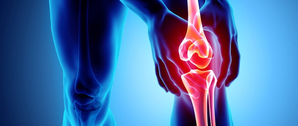 Деформуючий остеоартроз: клініка, діагностика, лікування